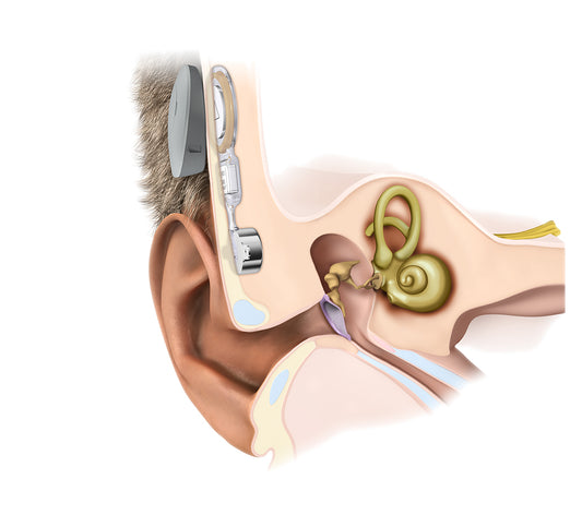 How Do Hearing Aids Work?