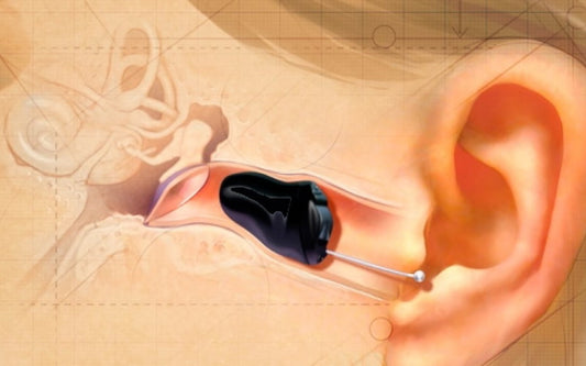 Exploring In-Ear Hearing Aids: Pros, Cons, Features & More
